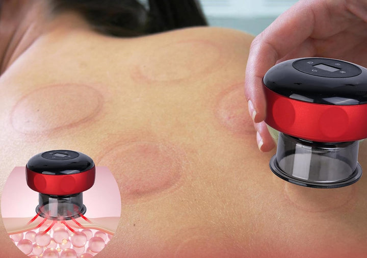 Elektrische Vakuum-Schröpfmassage